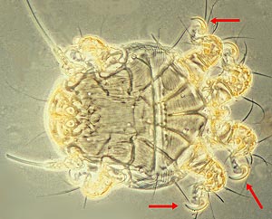Chaetodactylus mite hypopus, phase contrast photo